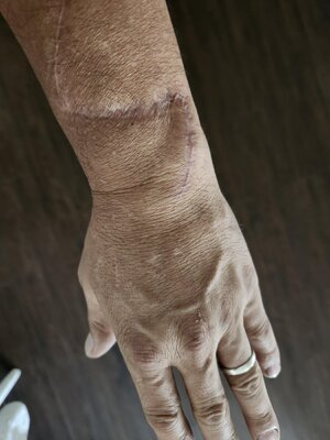 Hand Healed.jpg